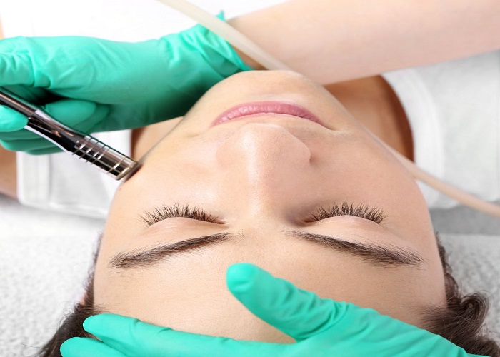 Microdermabrasion